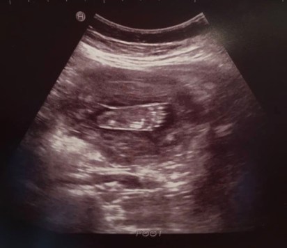 13335659_10155000183928065_314024177715163212_n